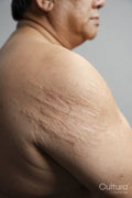 Profile view of man arm with scars against gray background